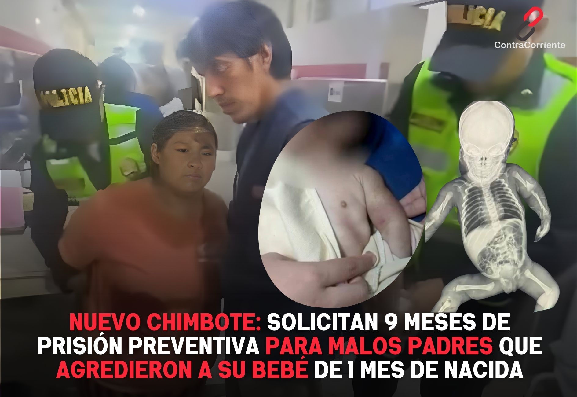 Nuevo Chimbote: Solicitan 9 meses de prisión para padres que agredieron a su bebé de forma salvaje